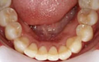 After - Staplehurstdentalpractice