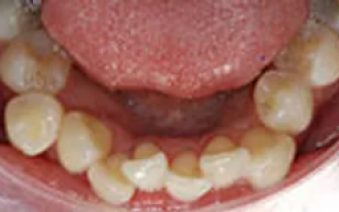 Before - Staplehurstdentalpractice