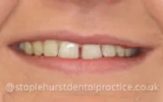 Before - Staplehurstdentalpractice