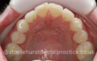 After - Staplehurstdentalpractice