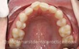 Before - Staplehurstdentalpractice