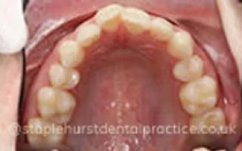 Before - Staplehurstdentalpractice