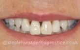After - Staplehurstdentalpractice