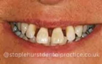 Before - Staplehurstdentalpractice
