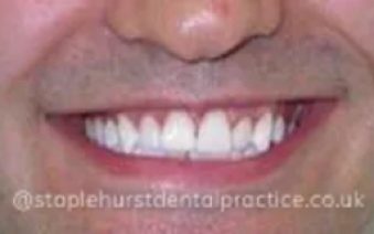 After - Staplehurstdentalpractice