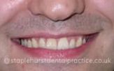 Before - Staplehurstdentalpractice