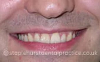 Before - Staplehurstdentalpractice