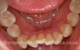 Before - Staplehurstdentalpractice