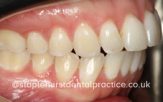 After - Staplehurstdentalpractice