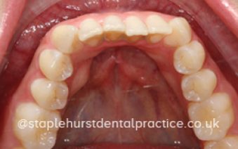 Before - Staplehurstdentalpractice