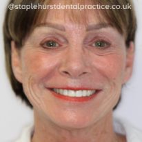 Full Image - Staplehurstdentalpractice