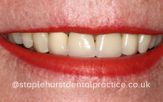 Before - Staplehurstdentalpractice