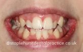 Before - Staplehurstdentalpractice