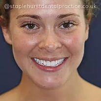Full Image - Staplehurstdentalpractice