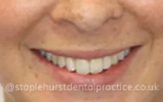 Before - Staplehurstdentalpractice