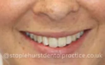 Before - Staplehurstdentalpractice