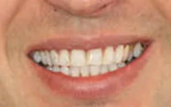 After - Staplehurstdentalpractice