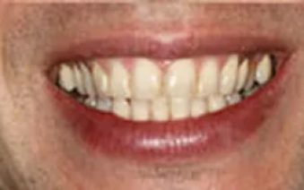 Before - Staplehurstdentalpractice