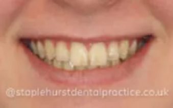 Before - Staplehurstdentalpractice