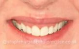 After - Staplehurstdentalpractice