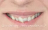 Before - Staplehurstdentalpractice