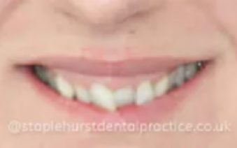 Before - Staplehurstdentalpractice