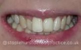 Before - Staplehurstdentalpractice