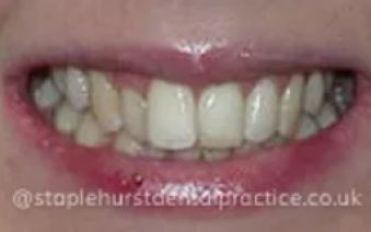 Before - Staplehurstdentalpractice