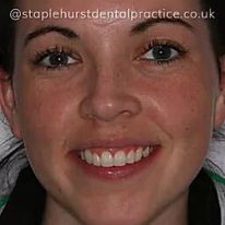 Full Image - Staplehurstdentalpractice