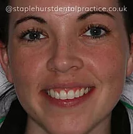 Full Image - Staplehurstdentalpractice
