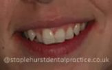 Before - Staplehurstdentalpractice