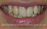 Before - Staplehurstdentalpractice