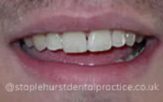 After - Staplehurstdentalpractice