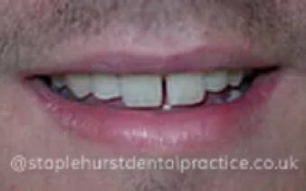 Before - Staplehurstdentalpractice