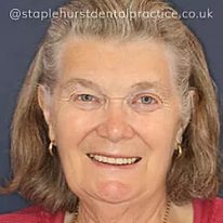 Full Image - Staplehurstdentalpractice