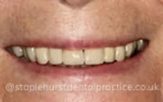After - Staplehurstdentalpractice