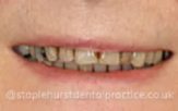 Before - Staplehurstdentalpractice