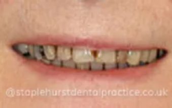 Before - Staplehurstdentalpractice