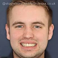 Full Image - Staplehurstdentalpractice