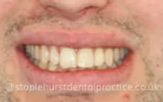 After - Staplehurstdentalpractice