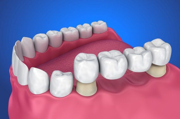 Treatment - Staplehurstdentalpractice