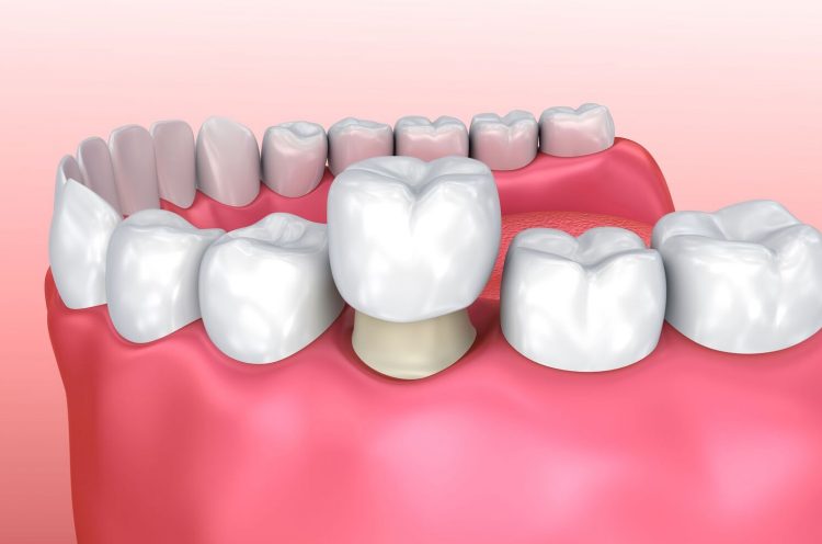 Treatment - Staplehurstdentalpractice