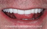 After - Staplehurstdentalpractice