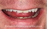 Before - Staplehurstdentalpractice