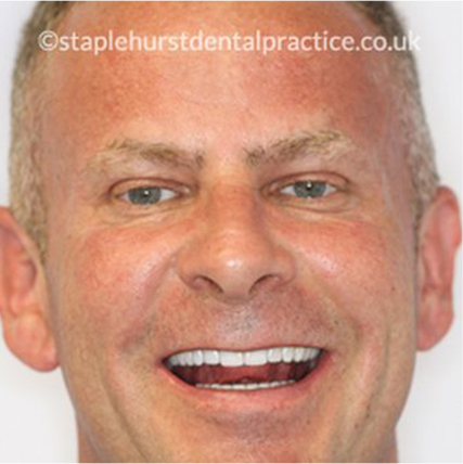 Full Image - Staplehurstdentalpractice