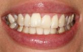 Before - Staplehurstdentalpractice