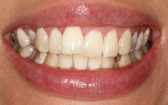 Before - Staplehurstdentalpractice