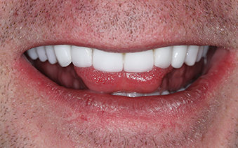 After - Staplehurstdentalpractice