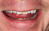 Before - Staplehurstdentalpractice
