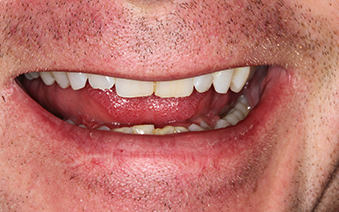 Before - Staplehurstdentalpractice